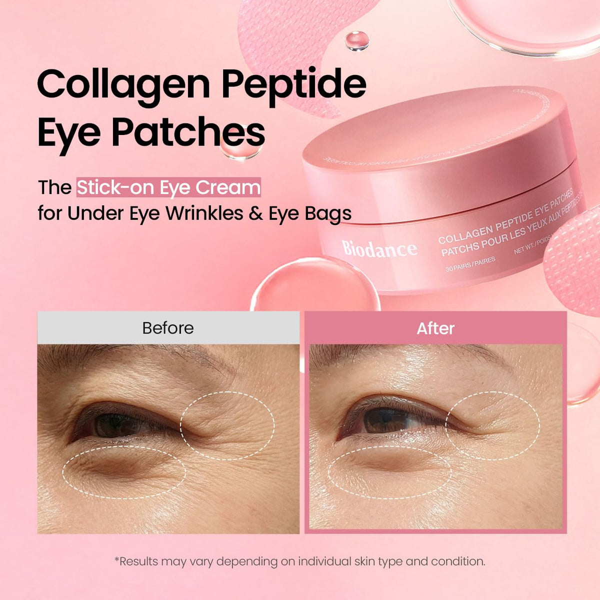 Adesivos de Hidrogel para a Área dos Olhos