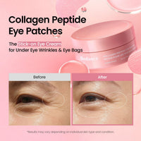 Adesivos de Hidrogel para a Área dos Olhos