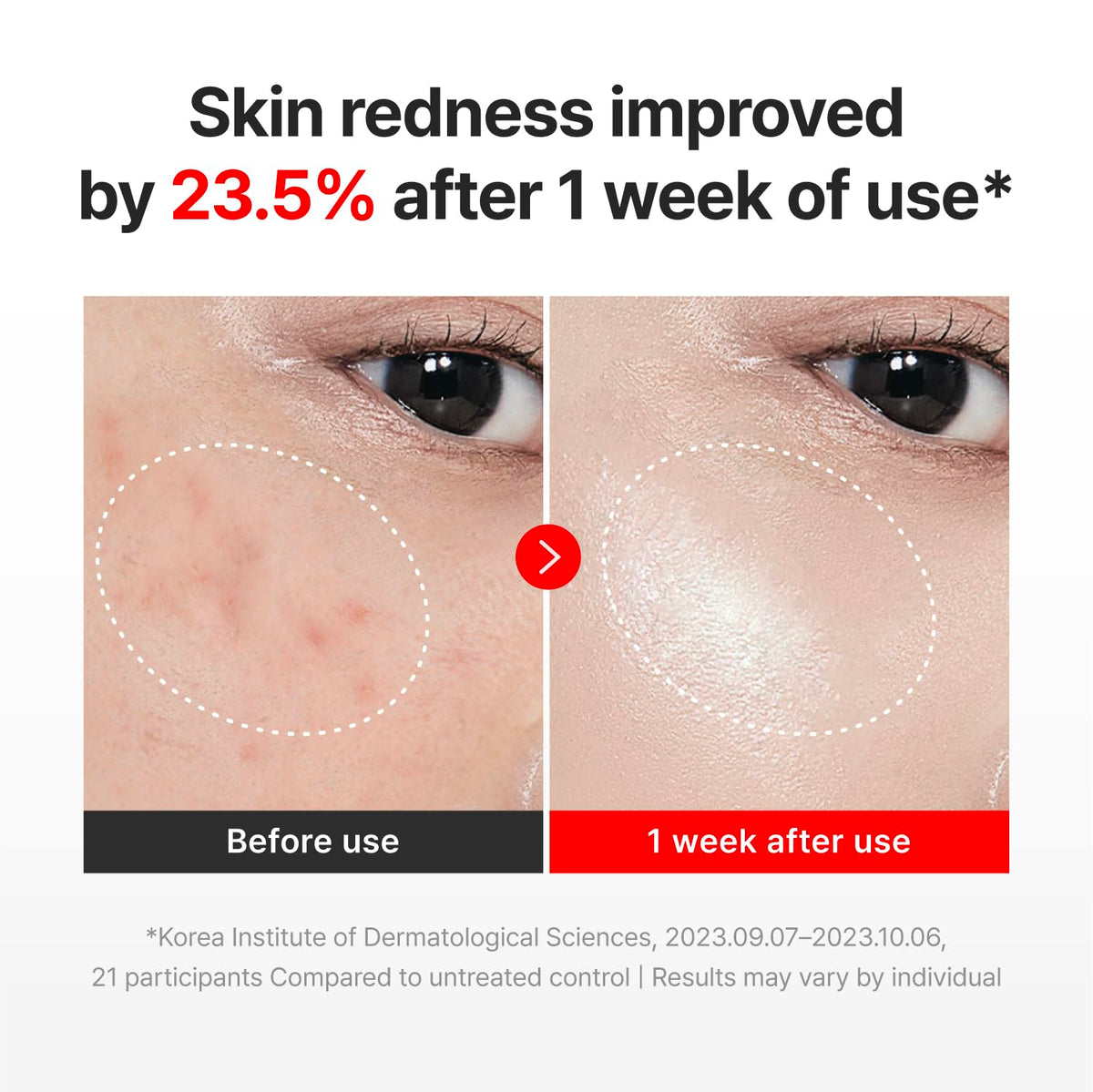 Madeca Creme Reversor do Tempo
