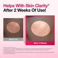 Niacinamide 10 + TXA 4 Serum