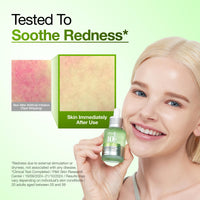 Suero Calmante para Enrojecimiento con Ácido Azelaico 10 de Anua, Suero Facial para Piel Sensible, Ácido Hialurónico, Niacinamida, Cuidado de Manchas, Color Natural, Vegano, Cuidado de la Piel Coreano (30ml/ 1.01 fl oz.)