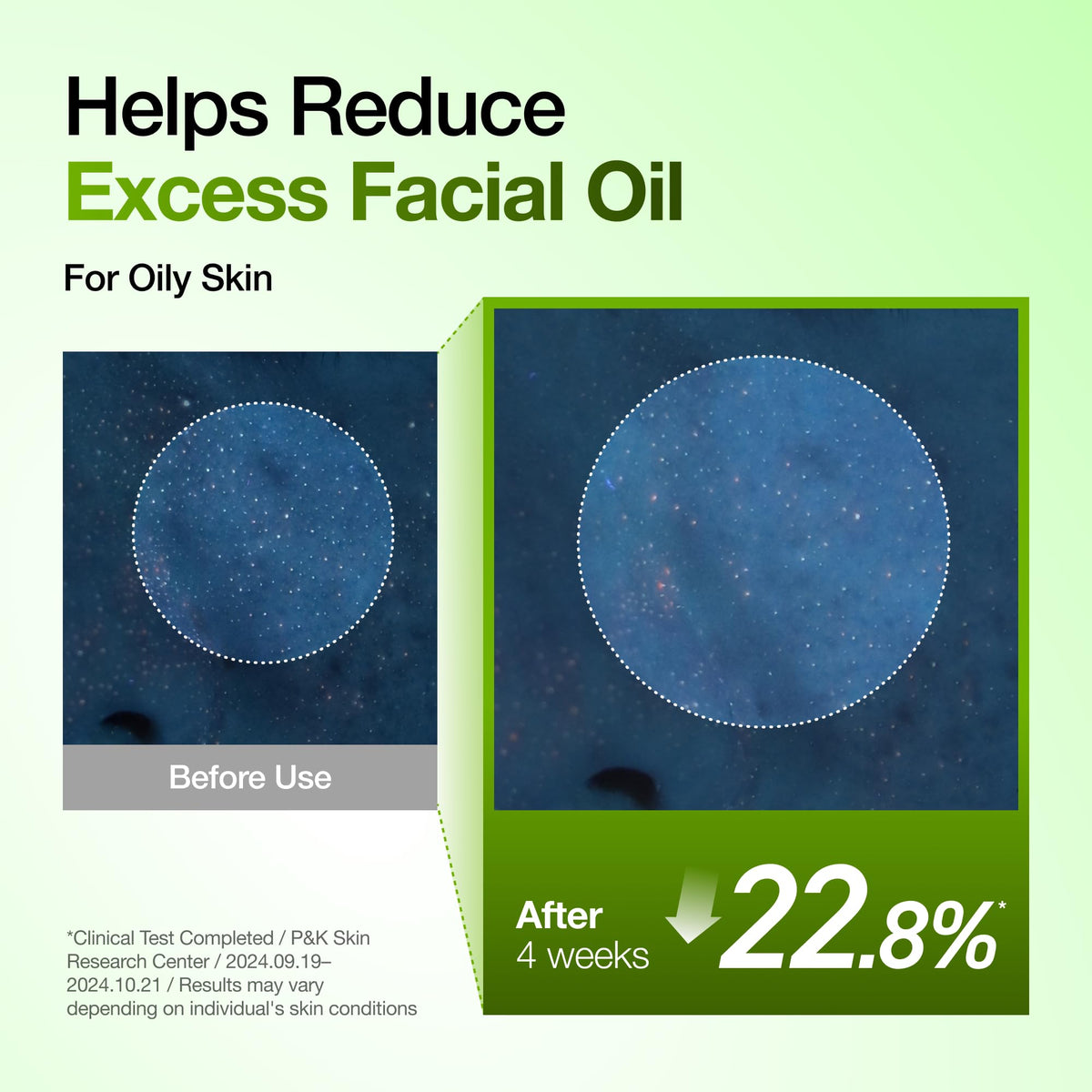 Suero Calmante para Enrojecimiento con Ácido Azelaico 10 de Anua, Suero Facial para Piel Sensible, Ácido Hialurónico, Niacinamida, Cuidado de Manchas, Color Natural, Vegano, Cuidado de la Piel Coreano (30ml/ 1.01 fl oz.)