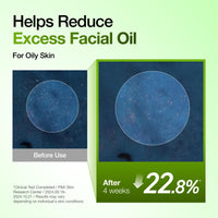 Suero Calmante para Enrojecimiento con Ácido Azelaico 10 de Anua, Suero Facial para Piel Sensible, Ácido Hialurónico, Niacinamida, Cuidado de Manchas, Color Natural, Vegano, Cuidado de la Piel Coreano (30ml/ 1.01 fl oz.)