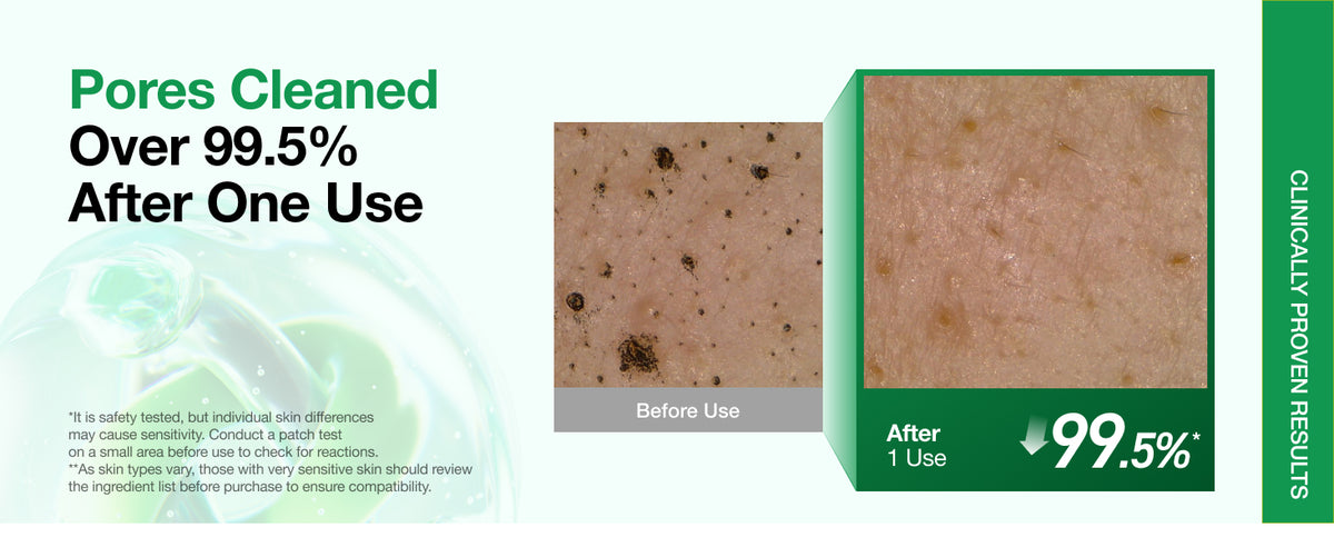 Espuma de Limpeza Profunda de Heartleaf