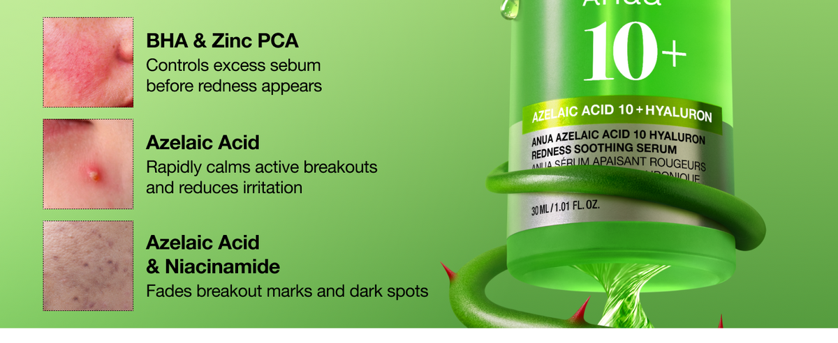 Suero Calmante para Enrojecimiento con Ácido Azelaico 10 de Anua, Suero Facial para Piel Sensible, Ácido Hialurónico, Niacinamida, Cuidado de Manchas, Color Natural, Vegano, Cuidado de la Piel Coreano (30ml/ 1.01 fl oz.)