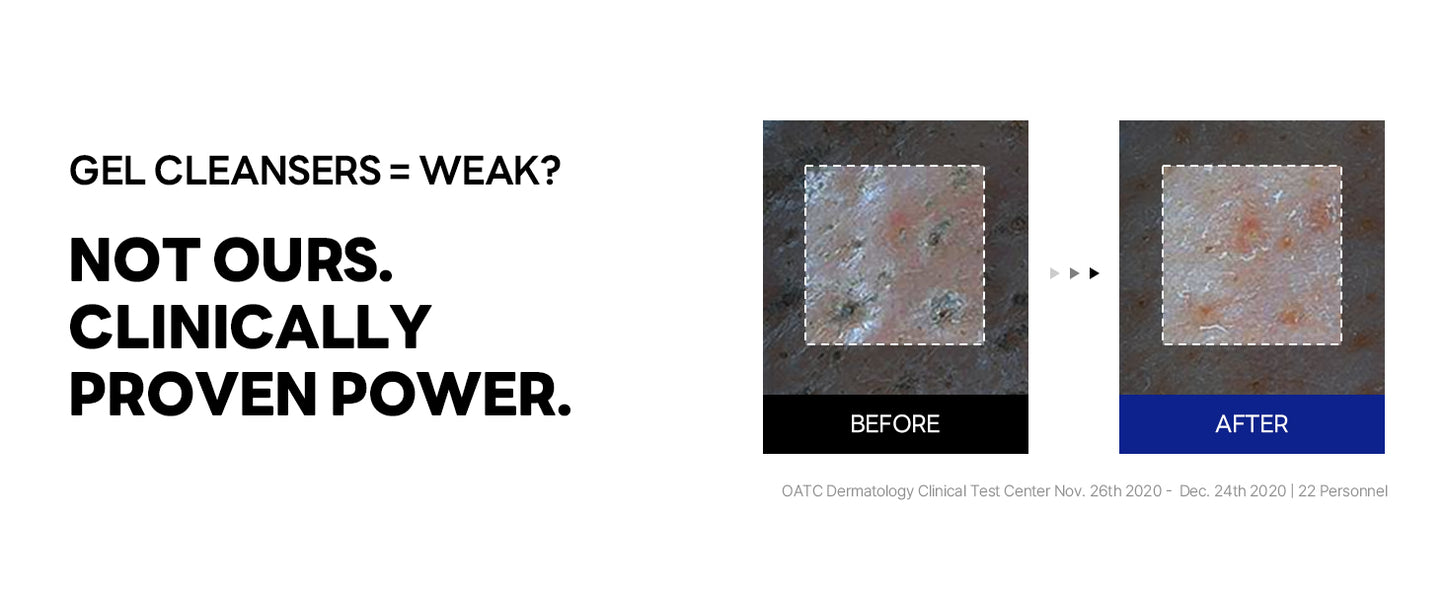 ROUND LAB Gel de Limpeza Hidratante com Suco de Bétula | Desobstrui o sebo oculto, Remove células mortas da pele, Calmante, pH baixo, Gel de Limpeza (150 ml)