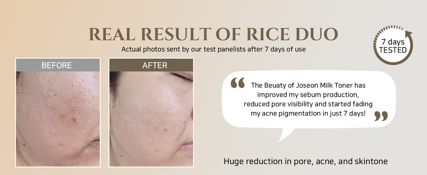 Beauty of Joseon Toner Facial de Sebo de Arroz Reabastecedor de Brilho para Pele Oleosa e Mista Coreano Hidratante de Equilíbrio 150ml, 5.07 fl.oz