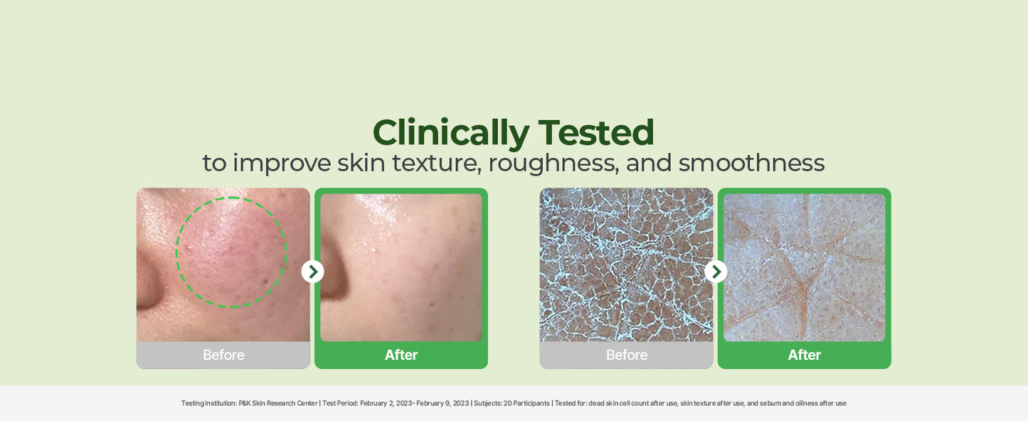 Torriden Discos de Tonificação BALANCEFUL (60 Unidades) | Esfoliação Diária com PHA e LHA para Pele Oleosa, Mista e Sensível | 5D CICA, Pantenol