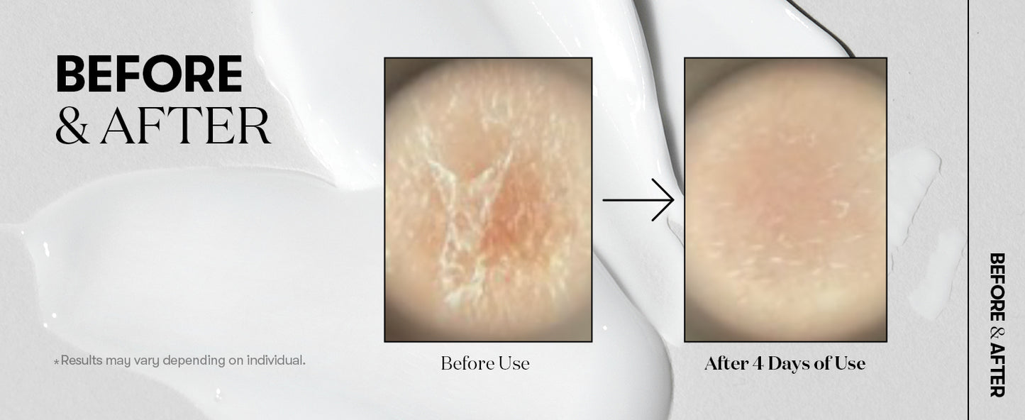 VT COSMETICS CICA Reedle Shot 100, Sérum de Microagulhamento com Espículas para Cuidado dos Poros e Esfoliação, Exossoma, Centella Asiatica para Pele Vidro, Textura da Pele, Potencializador Líquido Coreano para a Pele (1,69 Fl Oz / 50ml)