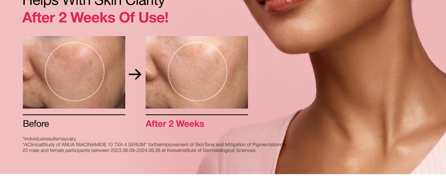  Sérum ANUA Niacinamida 10 + TXA 4, Ácido Hialurônico, Ácido Tranexâmico, Vitamina B12, Sérum Facial para Pele de Vidro, Tez Clarificante e Radiante com Cor Natural, Cuidados com a Pele Coreana (30ml / 1,01 fl.oz)