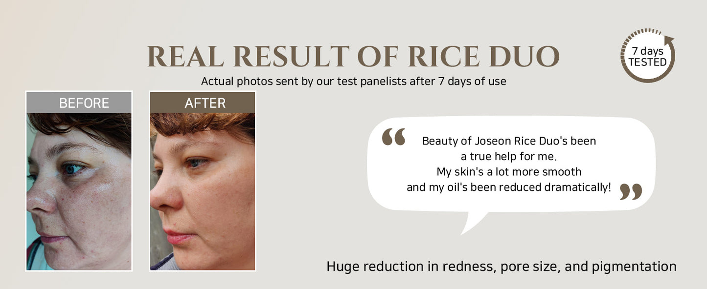 Beauty of Joseon Máscara Iluminadora de Arroz Moído e Mel Cuidado de Poros e Sebo para Pele Seca e Sensível Cuidados com a Pele Coreana 150ml, 5.07 fl.oz