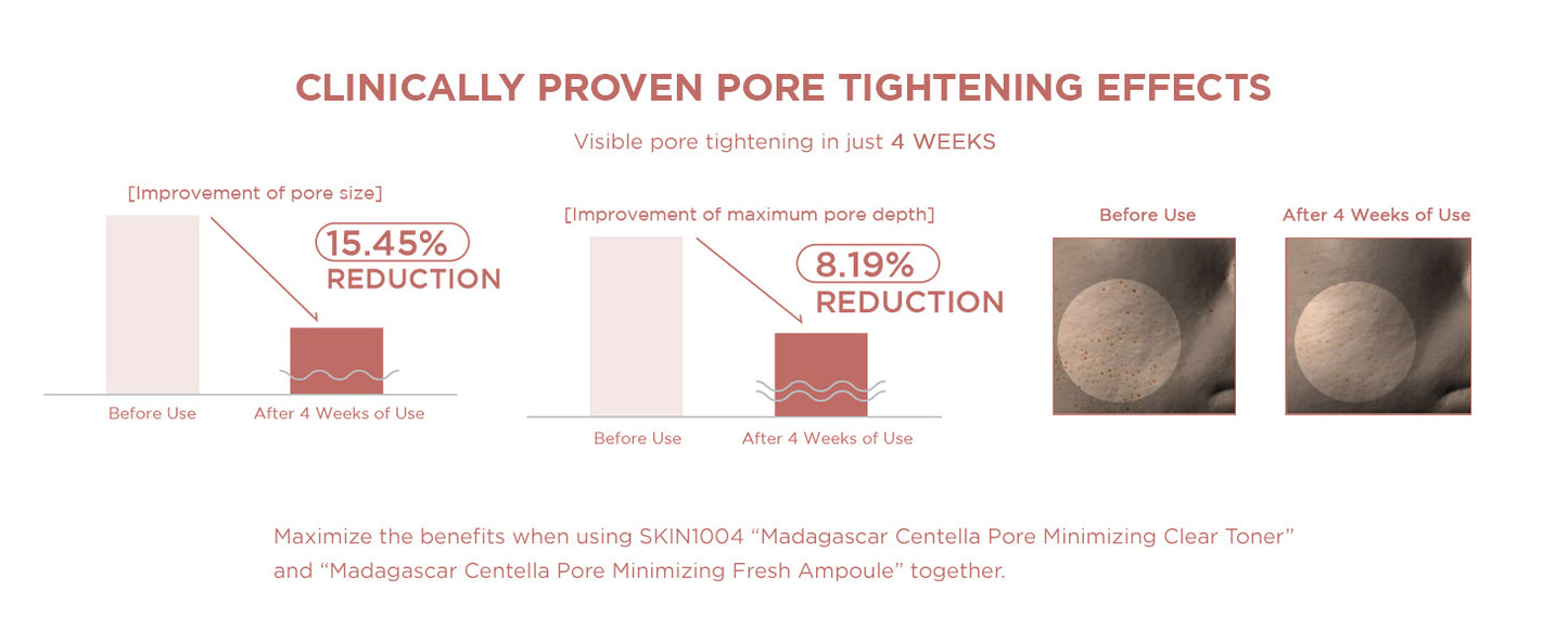 SKIN1004 Ampola Refrescante Madagascar Centella Poremizing 100 ml (3,38 fl. oz) | Hidratação Suavizante | Pele Oleosa e Mista