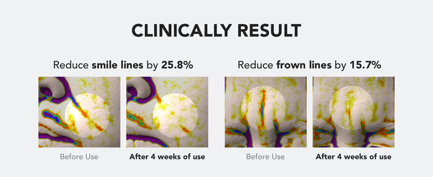  [SKIN&LAB] Sérum Reparador de Retinol | Contém Retinol Vegano, Bakuchiol e Peptídeos | Para Reduzir Rugas e Linhas Finas, Suavizante | Essência Facial Diária | Para Pele Sensível | 30 ml