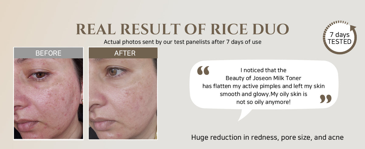 Glow Replenishing Rice Milk Toner