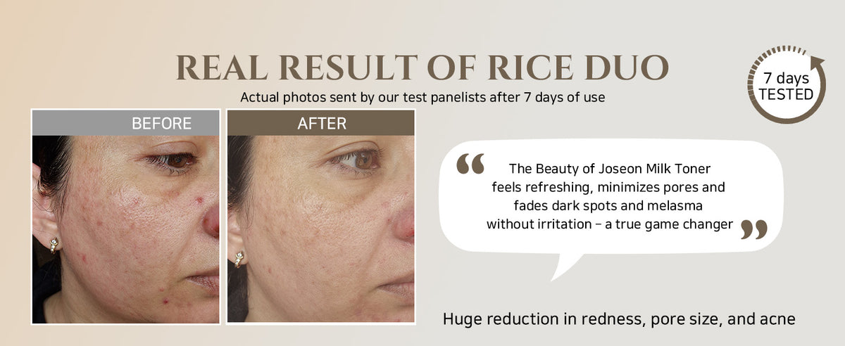 Glow Replenishing Rice Milk Toner