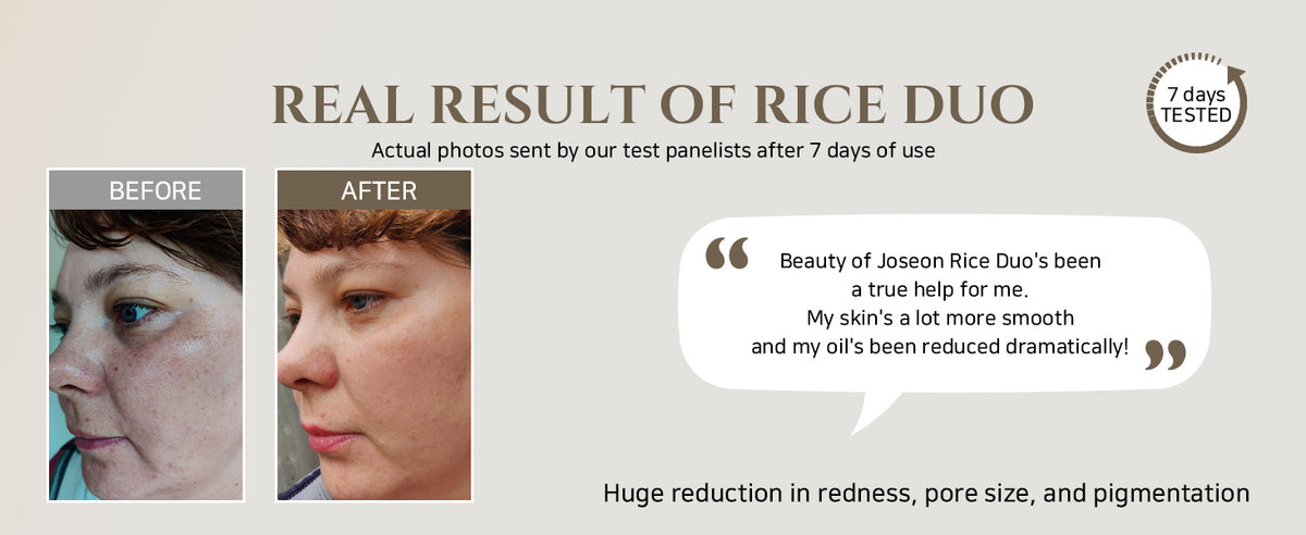 Glow Replenishing Rice Milk Toner