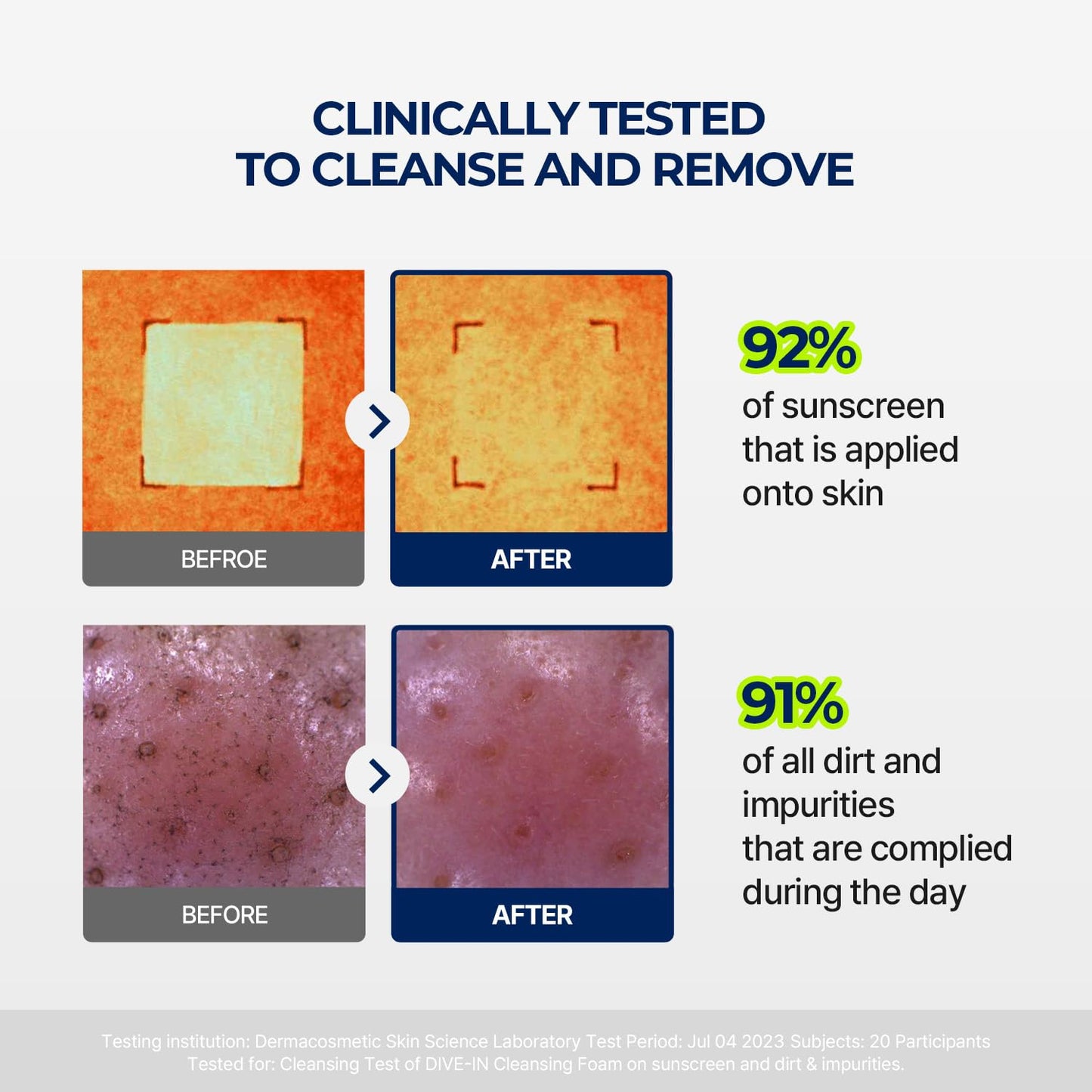 Torriden Espuma de Limpeza Facial DIVE IN 150ml (5,07 fl.oz.) | Limpador Facial Hidratante Diário para Todos os Tipos de Pele e Pele Sensível | Ácido Hialurônico, Pantenol, Alantoína