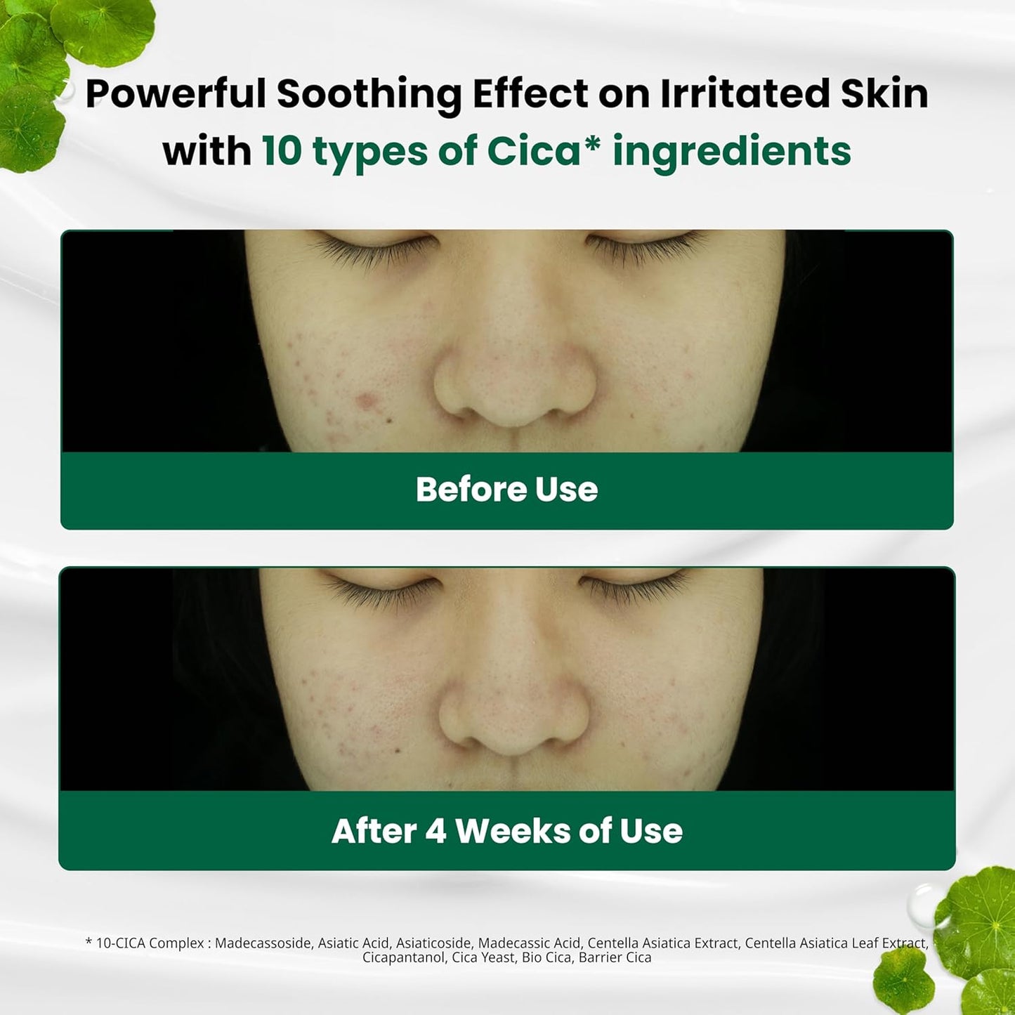 Dr.G Creme Facial Hidratante Calmante Clareador de Vermelhidão Coreano, 70ml - Cica Cream, Hidratante Coreano para a Pele, Hidratante Facial Coreano, Hidratante Facial, Skincare Coreana, K Beauty Skincare Coreano