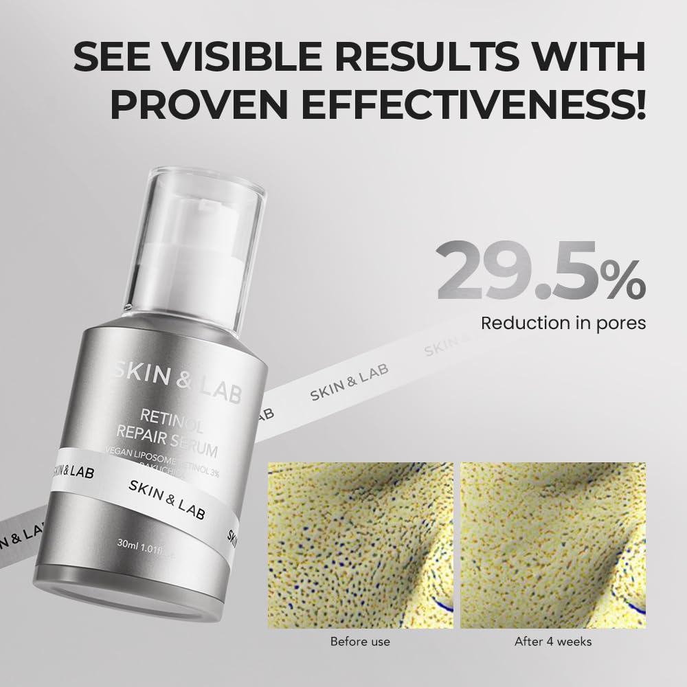  [SKIN&LAB] Sérum Reparador de Retinol | Contém Retinol Vegano, Bakuchiol e Peptídeos | Para Reduzir Rugas e Linhas Finas, Suavizante | Essência Facial Diária | Para Pele Sensível | 30 ml