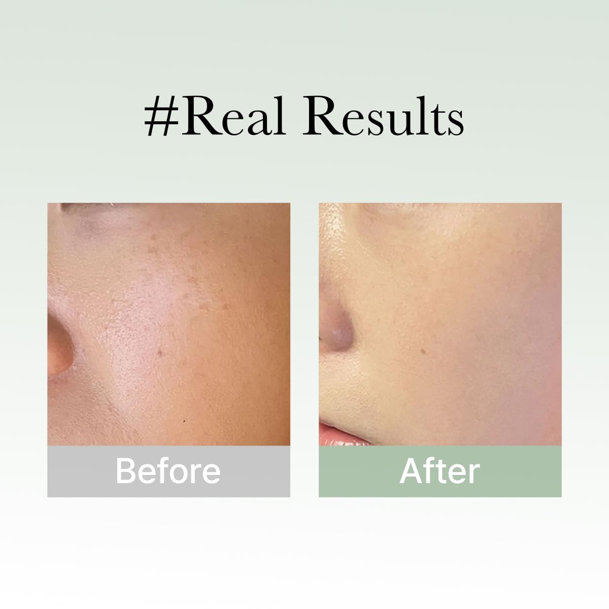 Arencia Glow Hyssop Máscara Facial Noturna em Sérum - Sérum Hidratante e Anti-Idade para Pele com Aparência Jovem e Efeito Vidro Coreano, 30% de Vitaminas A, C, E, 10% Niacinamida, Peptídeo