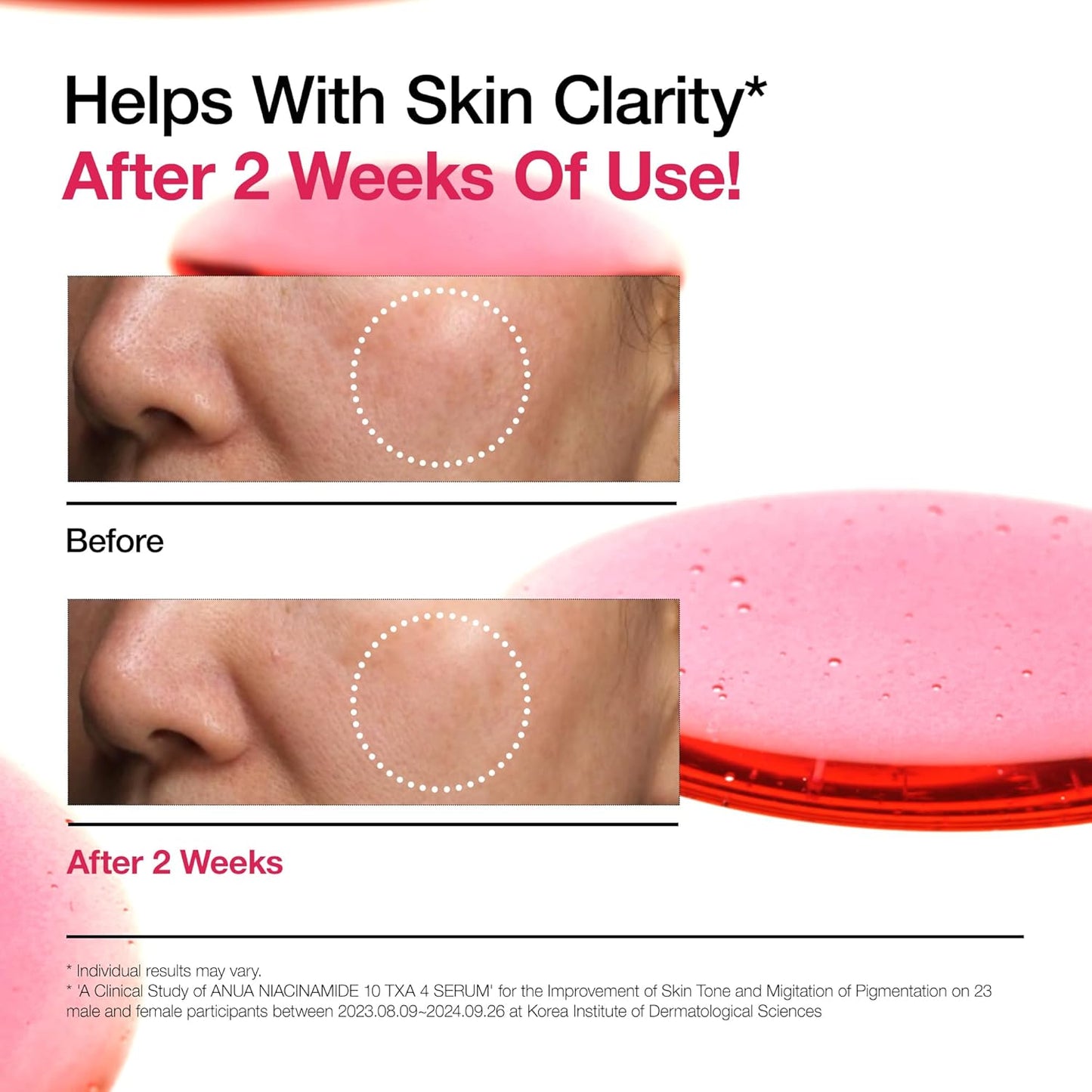  Sérum ANUA Niacinamida 10 + TXA 4, Ácido Hialurônico, Ácido Tranexâmico, Vitamina B12, Sérum Facial para Pele de Vidro, Tez Clarificante e Radiante com Cor Natural, Cuidados com a Pele Coreana (30ml / 1,01 fl.oz)