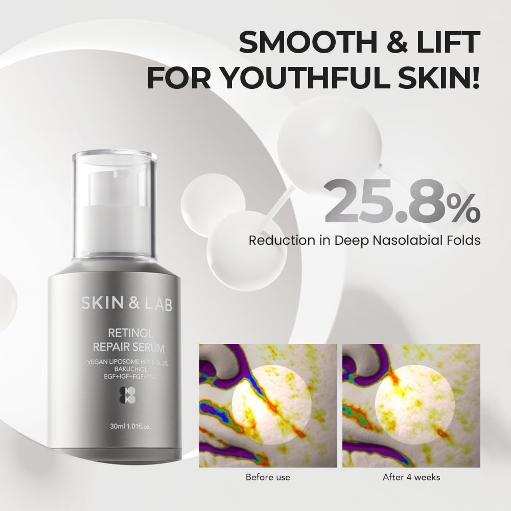  [SKIN&LAB] Sérum Reparador de Retinol | Contém Retinol Vegano, Bakuchiol e Peptídeos | Para Reduzir Rugas e Linhas Finas, Suavizante | Essência Facial Diária | Para Pele Sensível | 30 ml