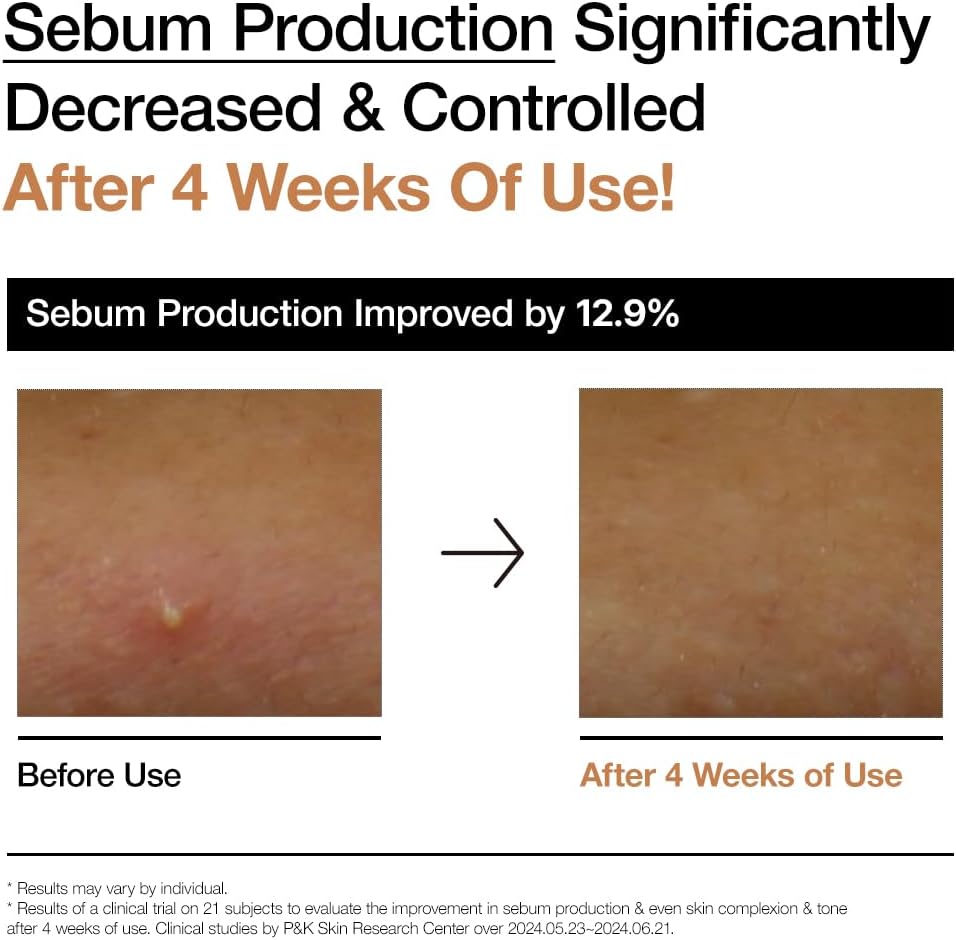  ANUA Rice 70 Glow Milky Toner, para Pele de Vidro, Água de Arroz, Niacinamida, Ceramidas, Pantenol, Sem Fragrância, Não Comedogênico, Seguro para Acne Fúngica, Cuidados com a Pele Coreana, 250ml/8.45fl.oz.