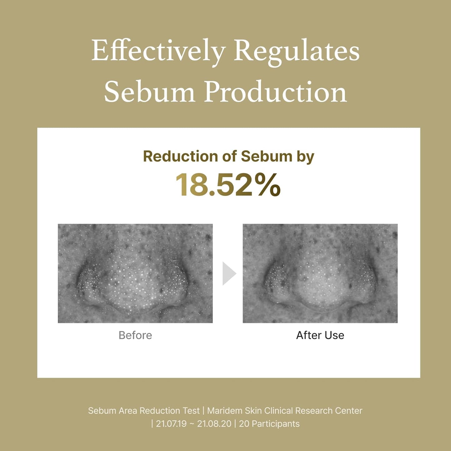 I'm from Essência de Artemísia | Extrato Vegano - Acalma a Pele Sensível e Irritada, Alívio da Vermelhidão, Refrescante, Tônico Hidratante Coreano | 160 ml, Todos os Tipos de Pele, Aprovado pela PETA