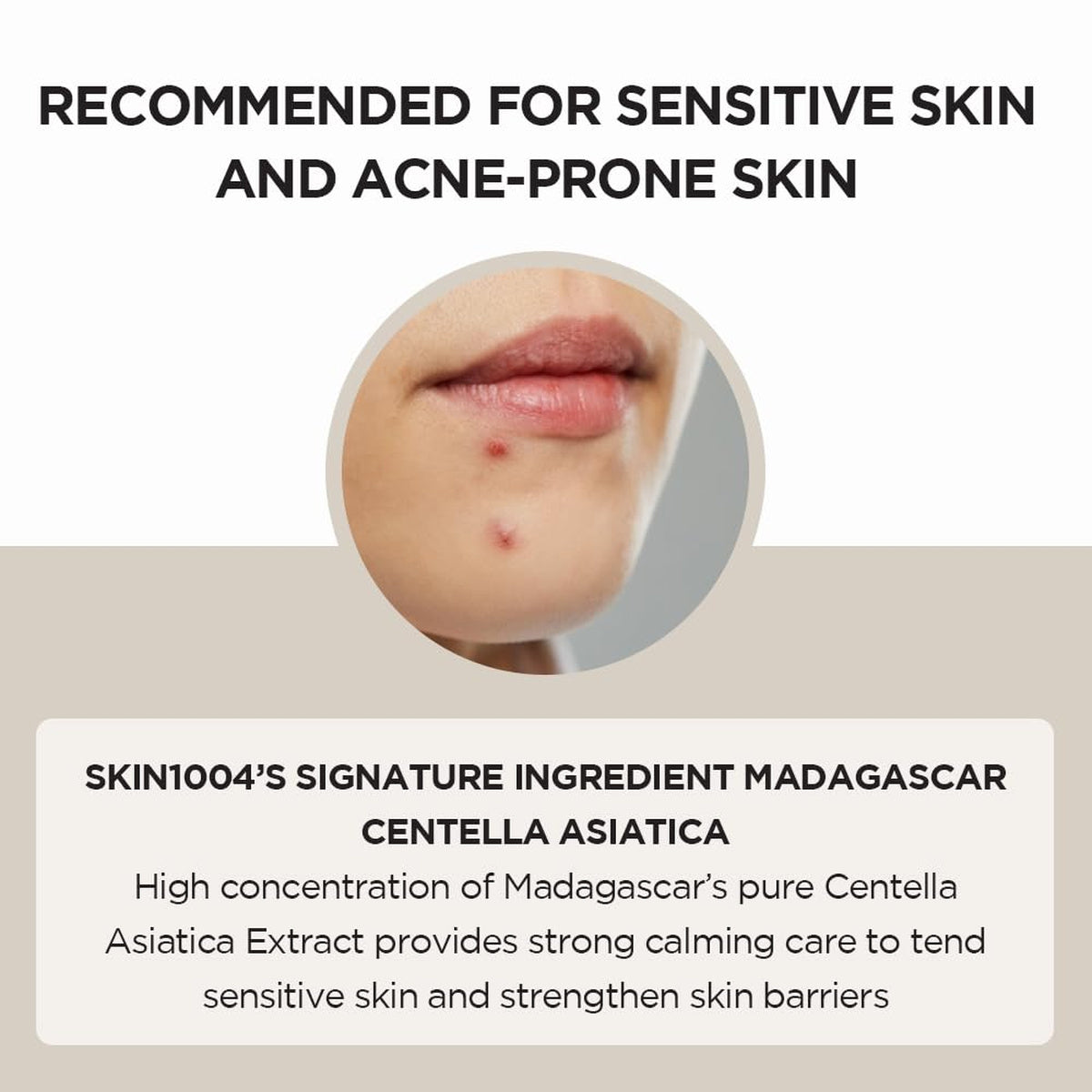 Madagascar Centella Ampoule Serum