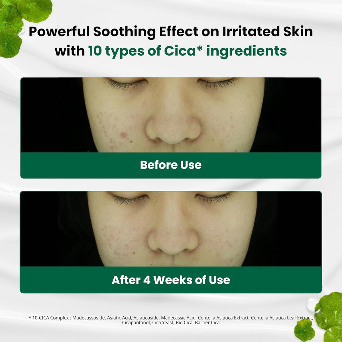 Red Blemish Clear Creme Calmante