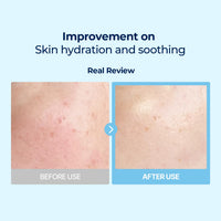 Torriden DIVE IN Multi Pad (80 pads) | Almohadillas faciales con suero para enfriar, calmar e hidratar | Ácido hialurónico, pantenol, alantoína